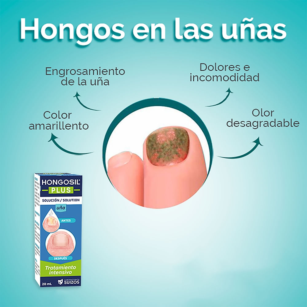 Comprar Medicamento Hongosíl Plus - 20 ml | Walmart El Salvador - La ...